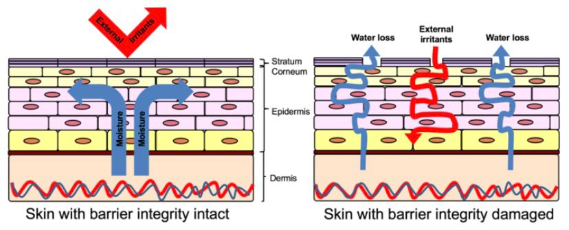 trans epidermal water loss trans epidermal water loss