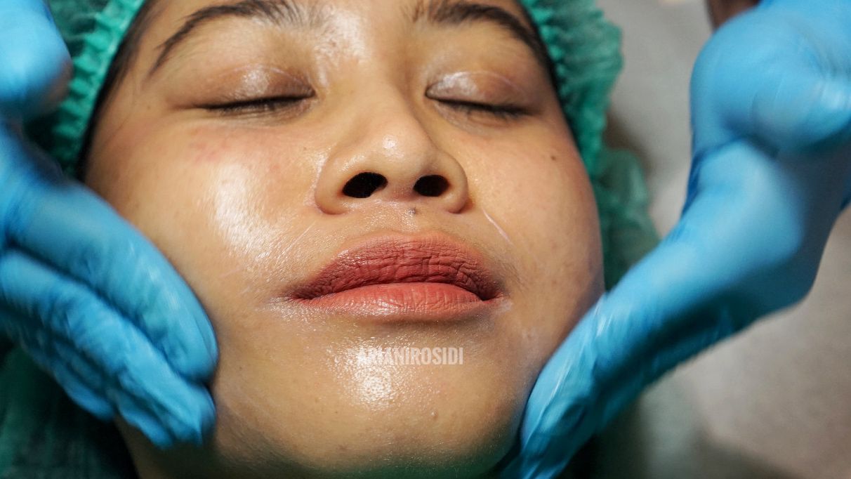 treatment ERHA untuk jerawat treatment ERHA untuk jerawat
