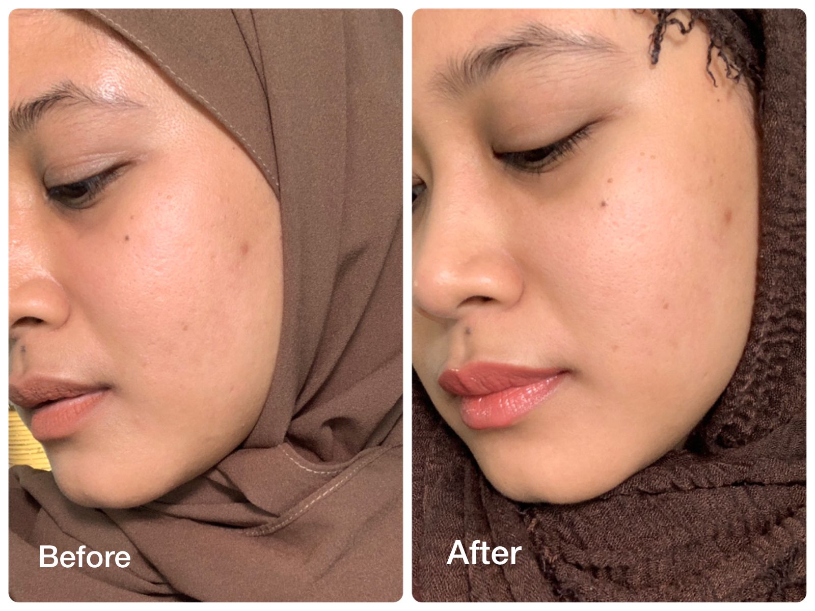 treatment erha treatment erha